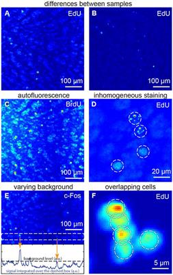 DALMATIAN: An Algorithm for Automatic Cell Detection and Counting in 3D